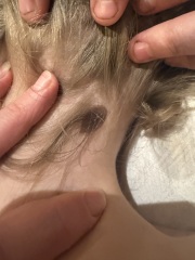 Mole/Birthmark changes