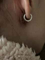 Lumps behind ears