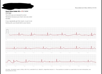 Pulse in 30s? How low is too low?
