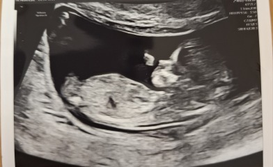 Boy or girl?