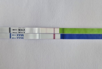 Faint lines/lines eyes? Disappearing lines?