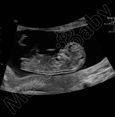 Nub and skull theory guesses - 12W 1 day