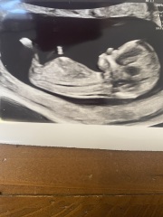 Any gender guesses? 13 weeks :)
