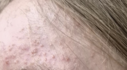 Any skin specialist here please? What is this on my child face?