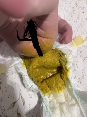Loose/watery bowel movement - FF