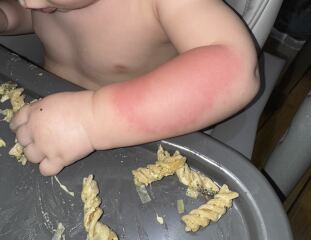 Any GPs out there that can help