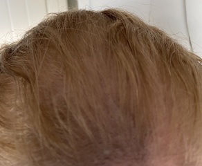 Help, dyed hair orange before sons christening!