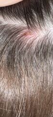 What’s on my scalp 😬