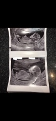 Gender guesses????!