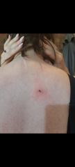 Does this look like shingles?