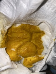 Is this poop normal? (TMI pictures)