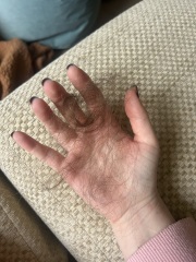 I’m actually ready to shave my hair off I can’t  cope with this.