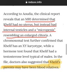 Survey on culture in the UK - 'trans rights' questions