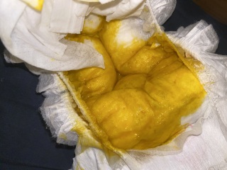 Is this poop normal? (TMI pictures)