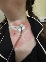 What cream will help me? Urgent