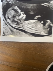 Any gender ideas from my 13 week scan? :)