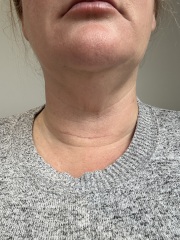 Thyroid surgery due soon