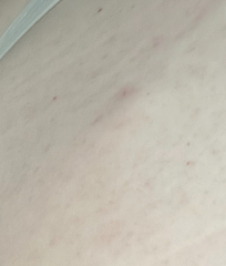 WTF is this lump