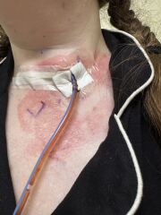 What cream will help me? Urgent