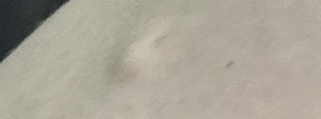 WTF is this lump