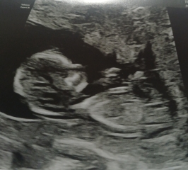 Due june 2026 gender gusse
