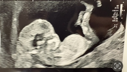 Can you guess baby’s gender?