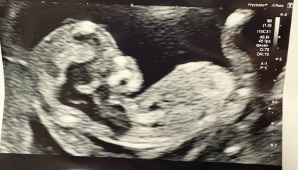Can you guess baby’s gender?