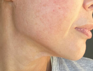 Anyone else stopping due to how aging losing weight is?!