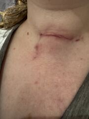 Will this scar get any better?