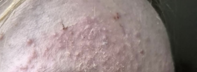 Any skin specialist here please? What is this on my child face?