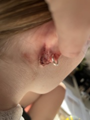 Lumps behind ears