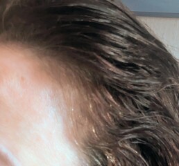 Grey hair