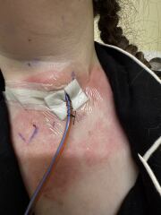 Will this scar get any better?