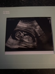 13 week scan…any guesses on gender?