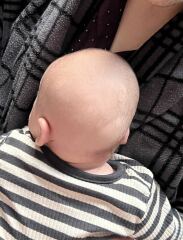 How bad is my son's plagiocephaly/flat head?