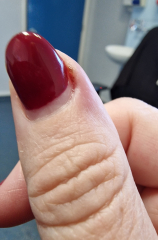 What are these black dots / marks on my daughter’s hands