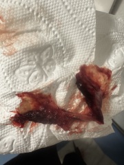 On my period .. wth is this? Warning sensitive picture