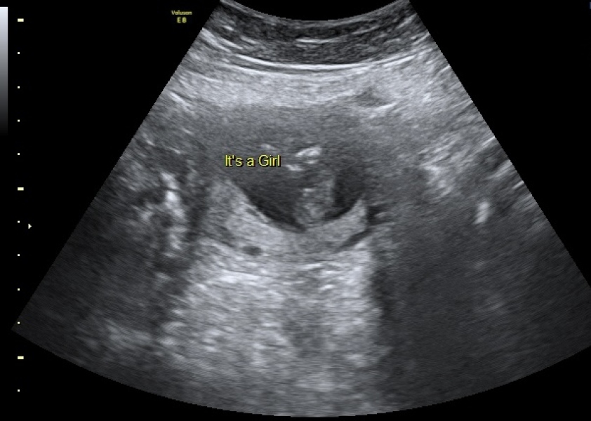 Can anybody else confirm this scan