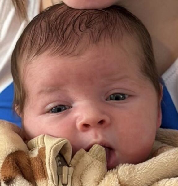 Baby head shape looks weird?