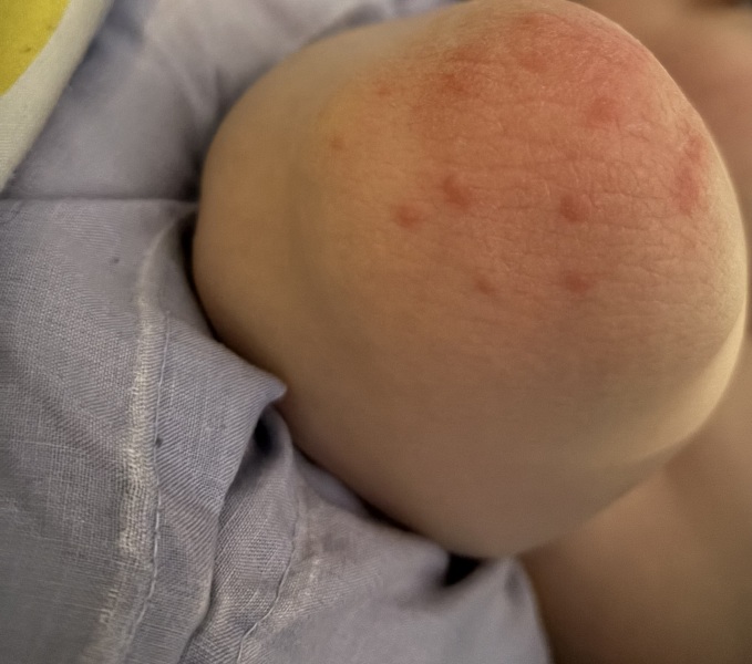 Possible HFM? Or something else