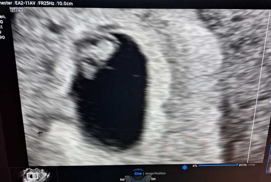 ☀️🏖👶🏻🍼🤰Due in August ☀️🏖👶🏻🍼🤰