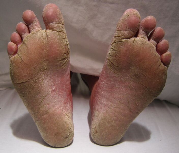 To think it's really rude to keep your shoes on when you visit someone's home