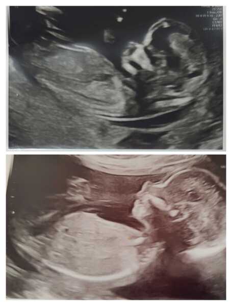 Gender guesses