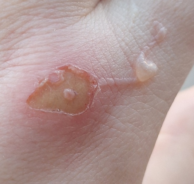 Do I need medical attention? Any Dr's about?