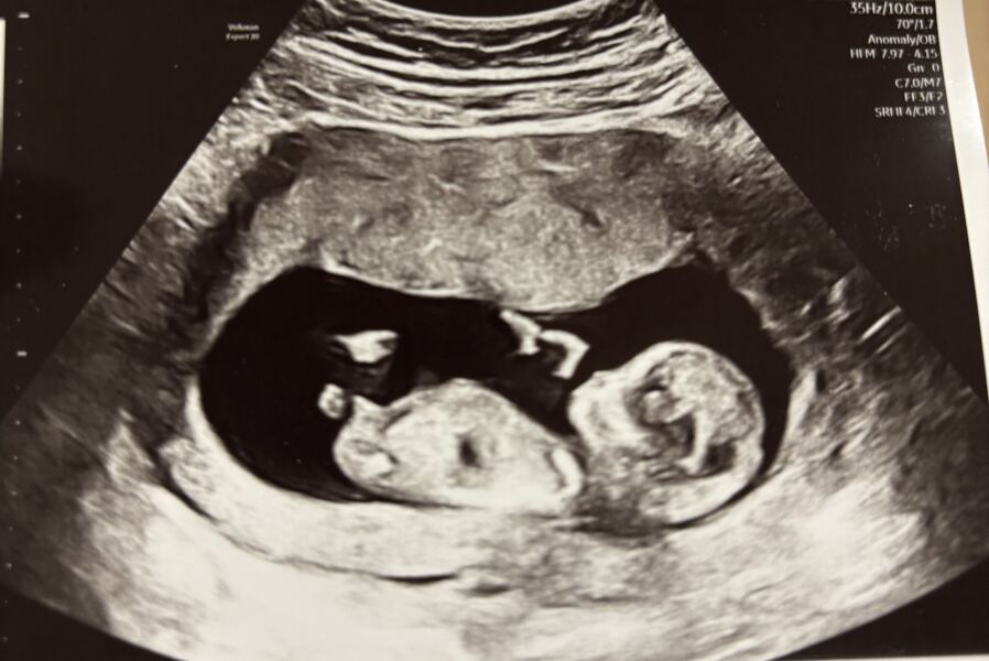Due July 2026 🤍