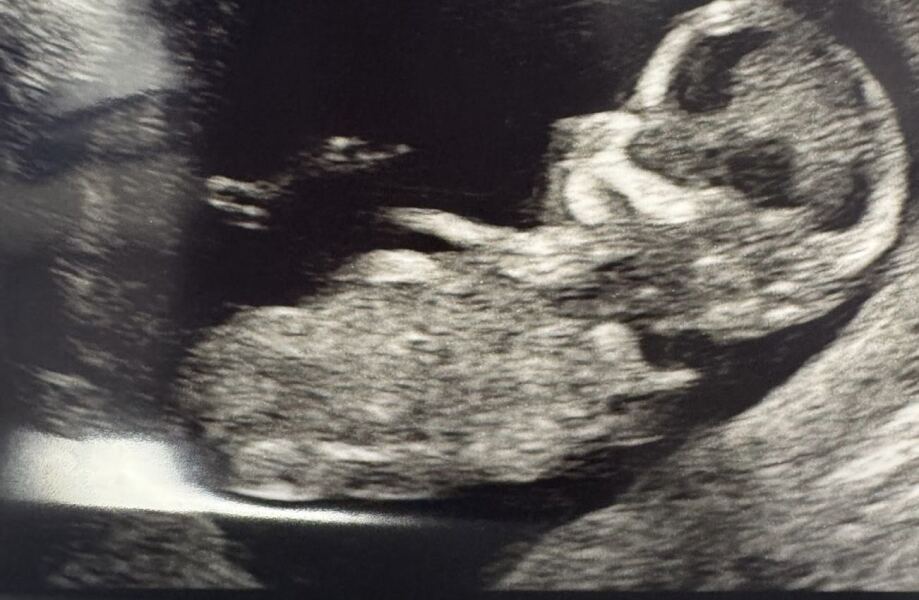 Early baby gender guesses? 12+1