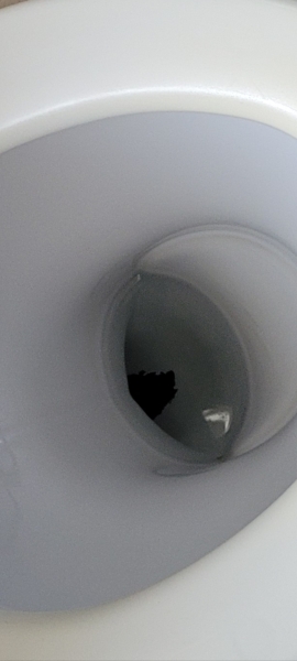 Does anyone know what this is in my toilet? (Image attached)