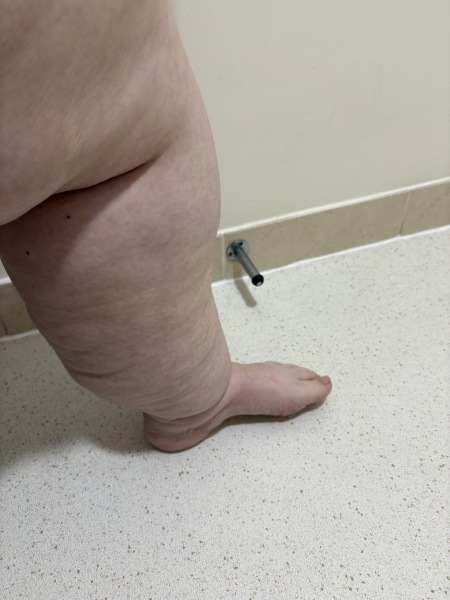 Mounjaro 10 stone or more to lose - Thread 10