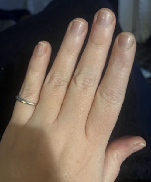 Help! Nails.