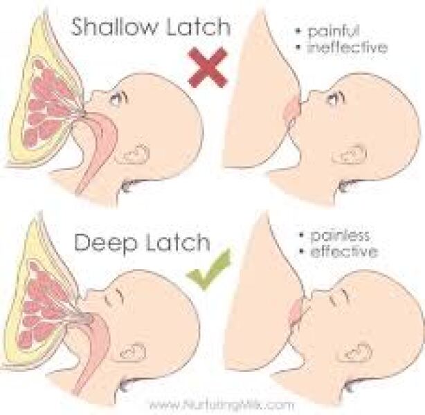 Breastfeeding pain - latching with teeth